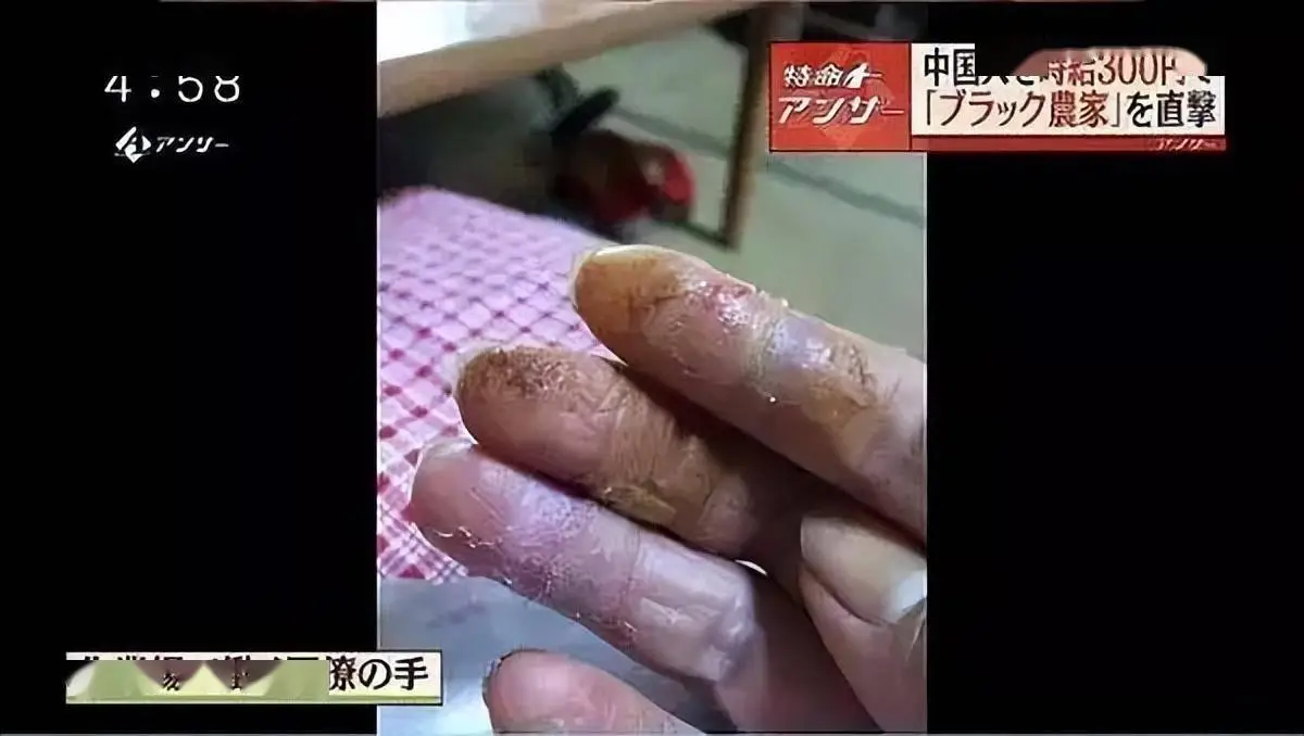 _研修生月薪承诺15万日元，实际收入却不足三分之一，钱去哪了_研修生月薪承诺15万日元，实际收入却不足三分之一，钱去哪了