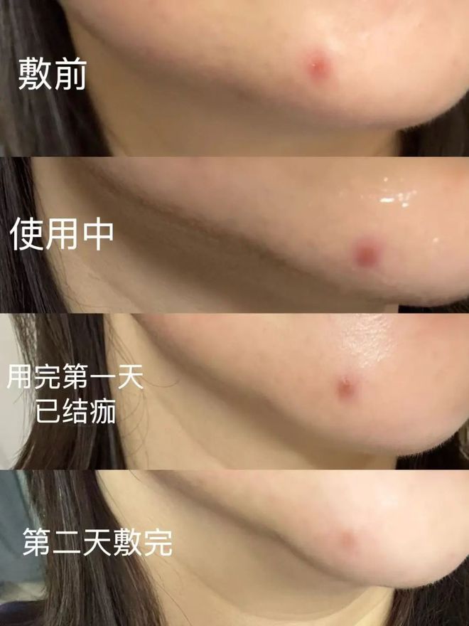 _豆腐面膜好用吗_豆腐面膜的作用与功效