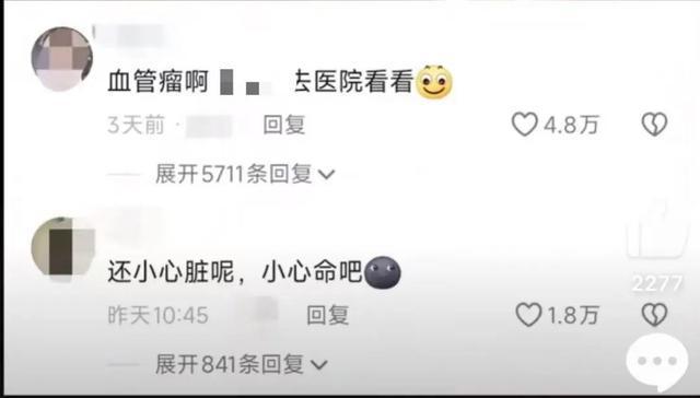 豆腐渣瘤手术要住院么_血管外皮瘤_
