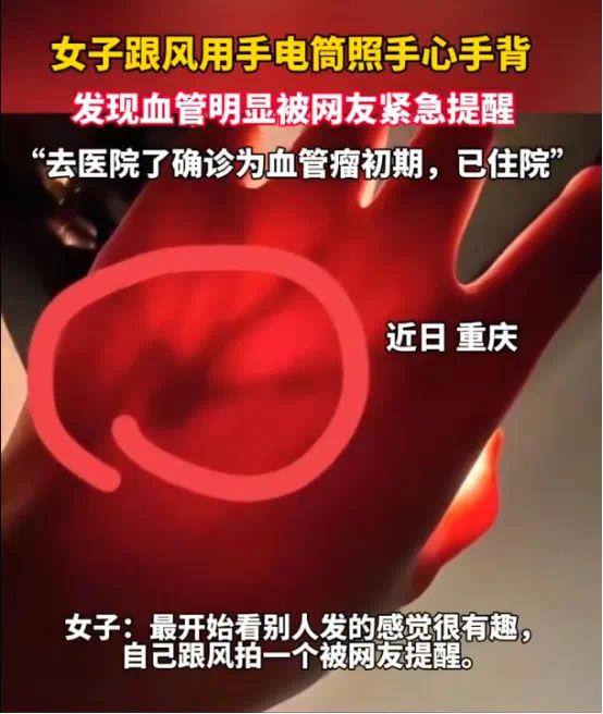 血管外皮瘤_豆腐渣瘤手术要住院么_