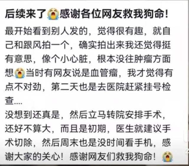 血管外皮瘤__豆腐渣瘤手术要住院么
