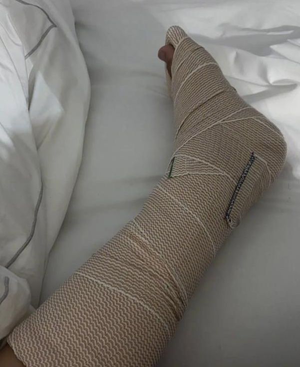 白发手术治疗_白发治疗案例_