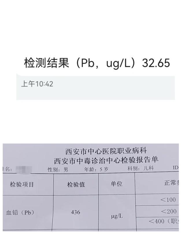 铅毒的危害_铅毒对人体的危害有多大_