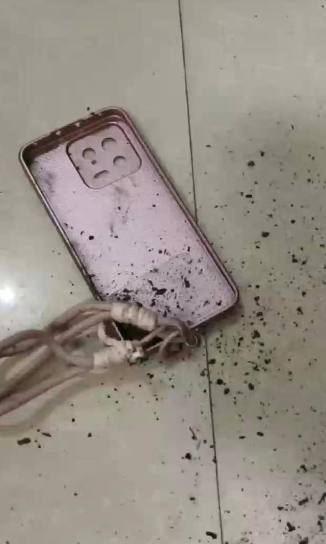 烧伤造成的手指合并__自燃起火什么原因