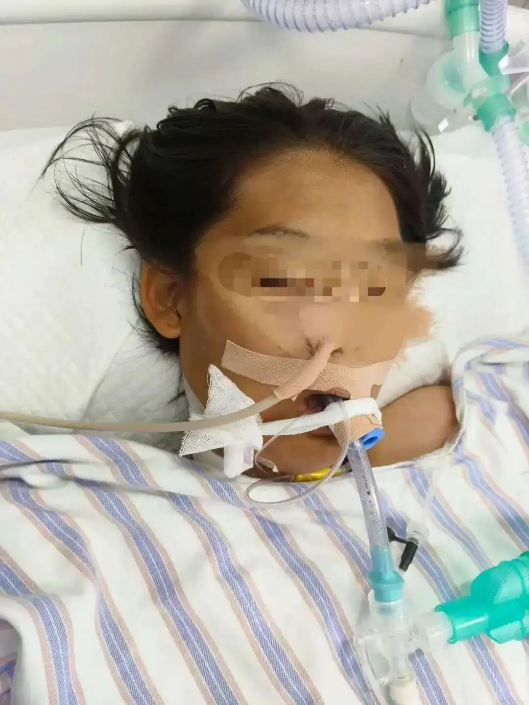 大学生见义勇为遭小偷刀捅身亡__2岁女童遭碾压身亡