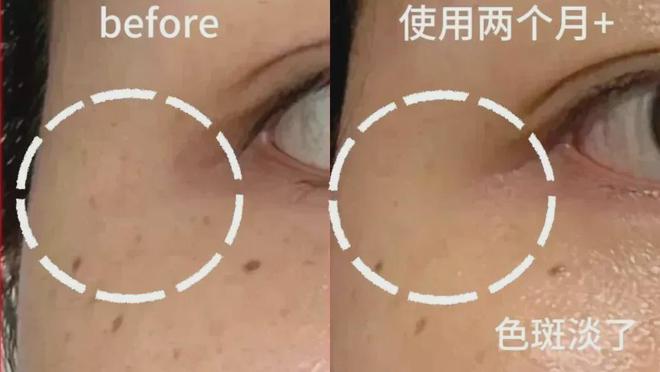 买项链是白金好还是黄金好_买面膜是京东好还是天猫好_
