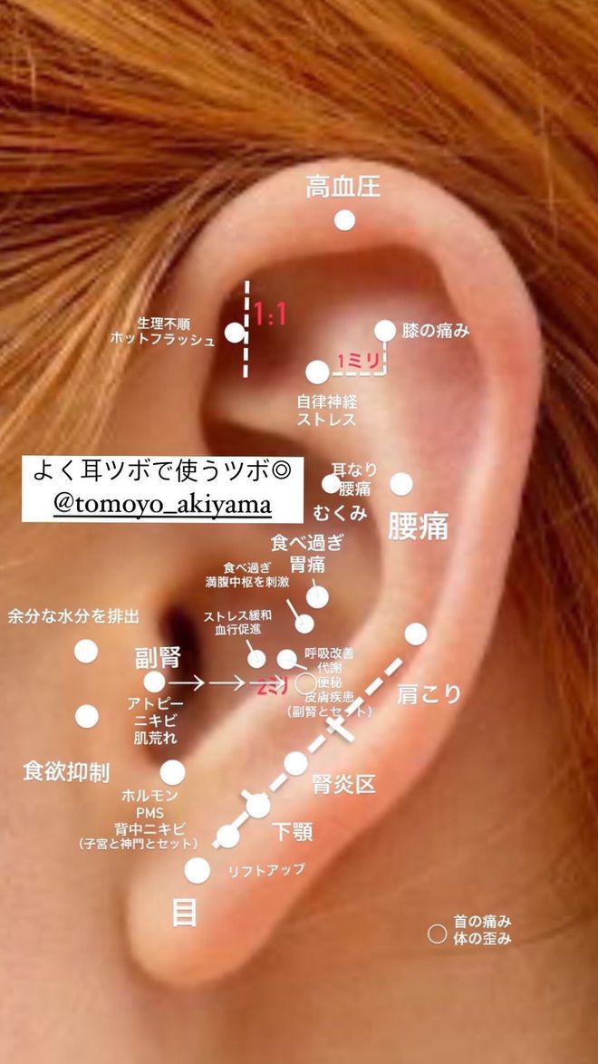 中医的耳穴埋豆，征服东京银座的高级美容院__中医的耳穴埋豆，征服东京银座的高级美容院