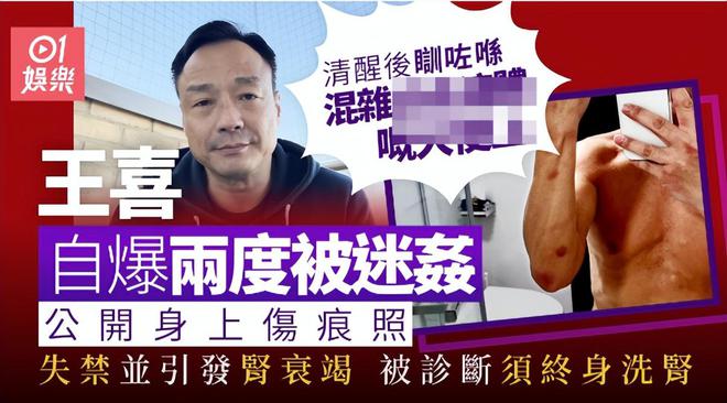 港星王喜自曝被两度侵犯后患肾衰竭，熟人作案没报警，需终身洗肾