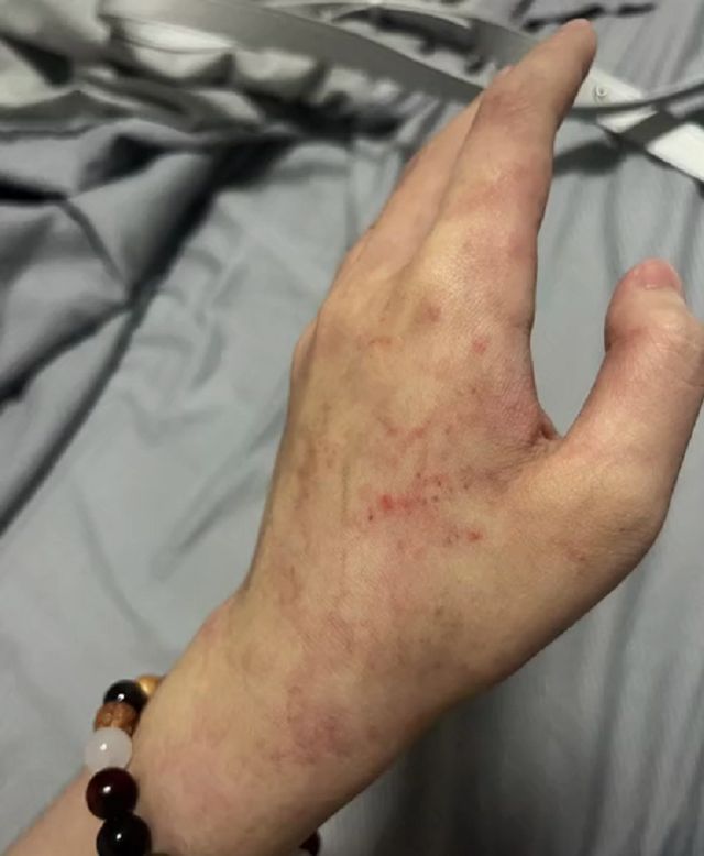 胸肺复苏按压_肺复苏指南中胸外按压的部位_