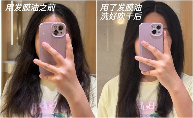 _推广|| 用了5年才来推荐，多亏它保住我的发际线_推广|| 用了5年才来推荐，多亏它保住我的发际线