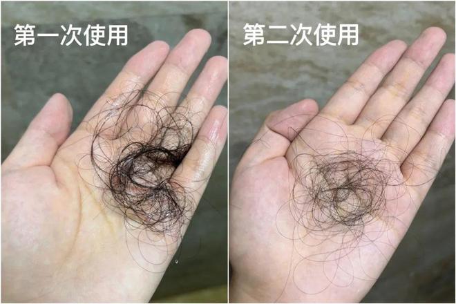 推广|| 用了5年才来推荐，多亏它保住我的发际线__推广|| 用了5年才来推荐，多亏它保住我的发际线