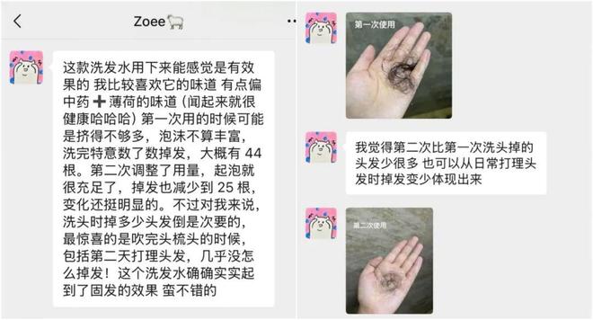 推广|| 用了5年才来推荐，多亏它保住我的发际线_推广|| 用了5年才来推荐，多亏它保住我的发际线_