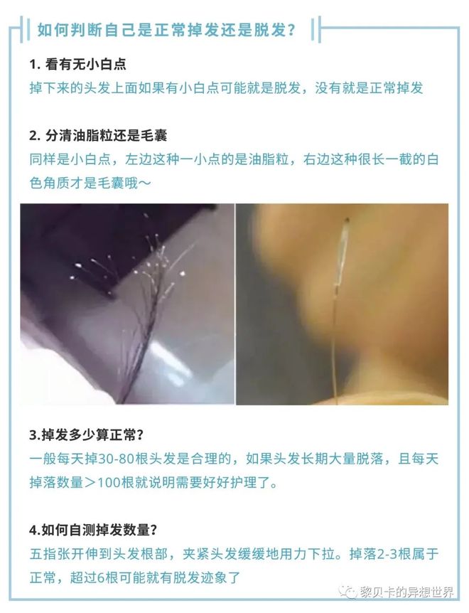 推广|| 用了5年才来推荐，多亏它保住我的发际线_推广|| 用了5年才来推荐，多亏它保住我的发际线_
