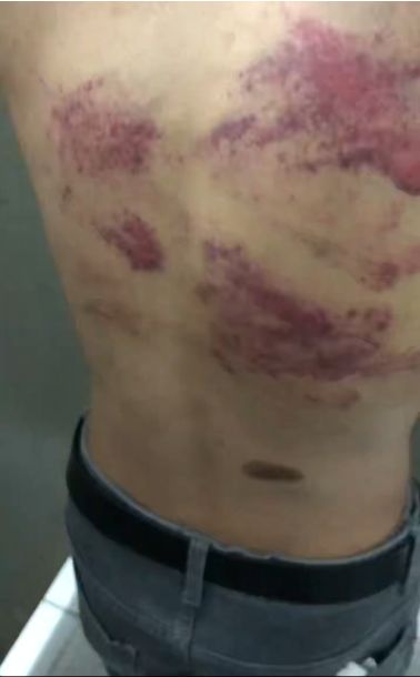 杭州诈骗案开庭_女子被骗到缅甸_