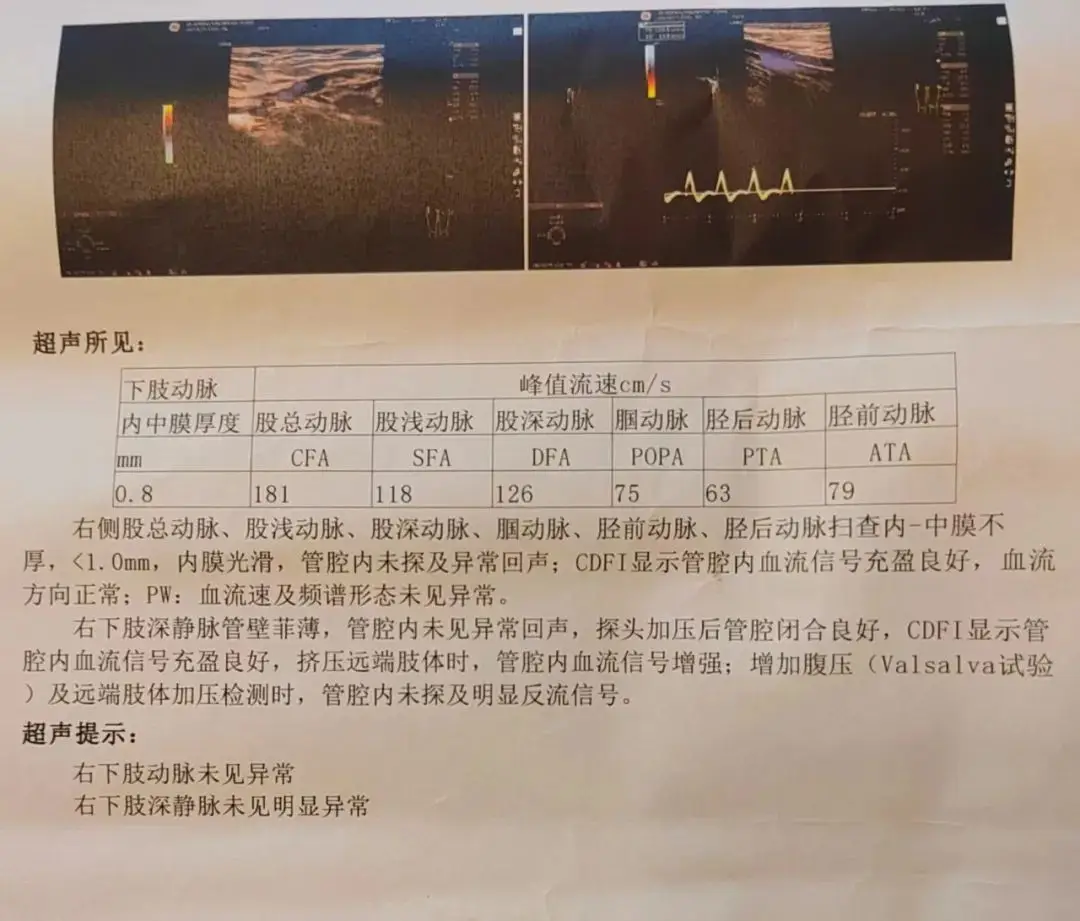 _浙江28岁单亲妈妈之死：千万不要一个人活成一支队伍_浙江28岁单亲妈妈之死：千万不要一个人活成一支队伍