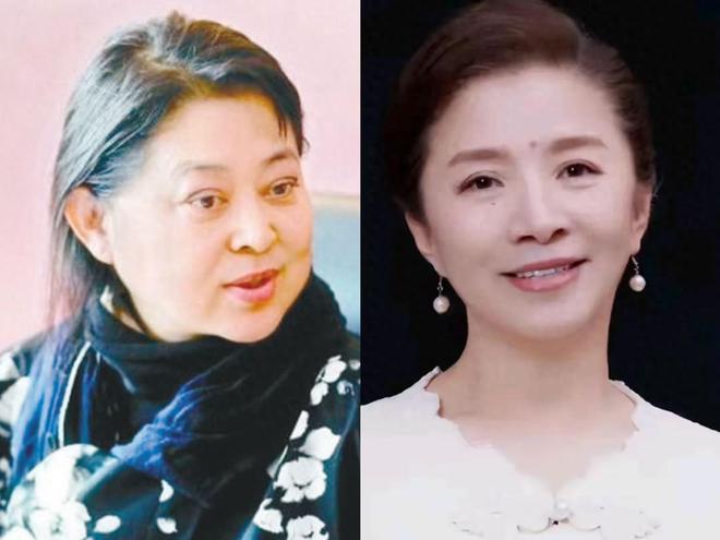 《生万物》“丑娘”迟蓬，用高超演技，打了多少内娱明星的医美脸
