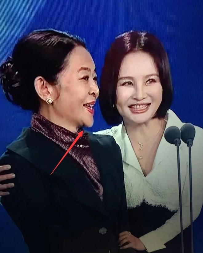 《生万物》“丑娘”迟蓬，用高超演技，打了多少内娱明星的医美脸__《生万物》“丑娘”迟蓬，用高超演技，打了多少内娱明星的医美脸