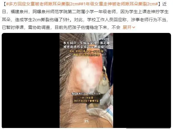 女孩被老师揪耳朵致2厘米撕裂缝针？ 官方：涉事教师已停课协助调查
