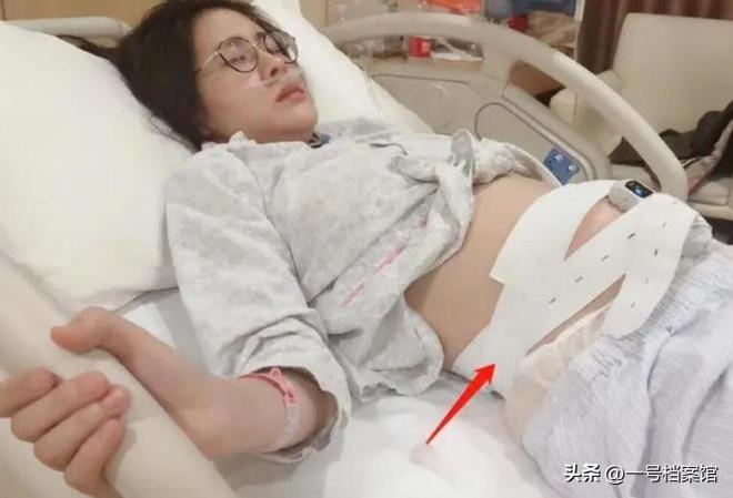 张碧晨被汪苏泷打脸体面碎一地，原来早有“前科”，华晨宇被坑惨__张碧晨被汪苏泷打脸体面碎一地，原来早有“前科”，华晨宇被坑惨
